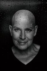 Andrea Kdolsky zeigt sich mutig mit Glatze.&nbsp;