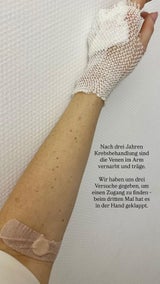 Patrice Aminati zeigt, dass ihr Körper in den letzten Jahren sehr viel durchgemacht hat.&nbsp;