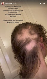 Patrice zeigt, wie ihre Haare wirklich aussehen.&nbsp;
