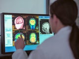 Studie zeigt: Viel Bauchfett lässt Ihr Gehirn schneller altern