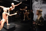 „Körperwelten“ zeigen was uns krank macht