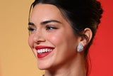 Bei Kendall Jenner sind Lip Flip und Lip Filler eindeutig