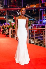 Bei der Berlinale strahlt Supermodel Toni Garrn im Neon-Kleid