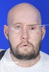 aUGEN op