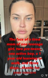 Adriana Lima über ihr Gesicht: "Darum sehe ich anders aus!"