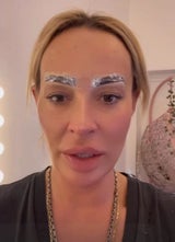 Cora Schumacher: Beauty-Fail vor Dschungel