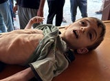Israel dementiert UN-Bericht zu drohender Hungersnot
