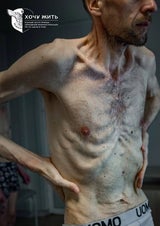 Schockierende Bilder: Putin lässt Kriegsgefangene verhungern