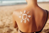 Bester SOS-Tipp: Kühlen und mit Feuchtigkeit versorgen sind die ersten Maßnahmen bei Sonnenbrand.  