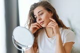 Face Mapping: Das verraten Pickel über unsere Gesundheit