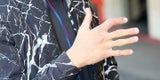 Vor Superbike-Auftakt in Australien: Toprak dominiert Tests trotz gebrochenem Finger