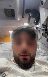 Enes Türke verprügelt