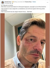 koza posting