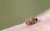 Insektengift: SO gefährlich sind Bienen- und Wespenstiche wirklich