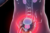 Prostatakrebs: Neues KI-Modell kann unnötige Prostata-Entfernungen verhindern