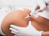 Brazilian Butt Lift: Darum ist die Beauty-OP die gefährlichste der Welt