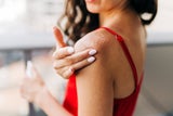 Aloe-Vera-Gels und Thermalwassersprays kühlen die Haut und spenden Feuchtigkeit.  