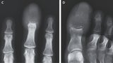 Viele vertrauen auf die Goldfaden-Akupunktur, auch in den Füßen diverser Patienten fand man Goldfäden nach der Behandlung.