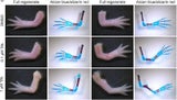Axolotls zeigen unterschiedliche Regenerationen der Gliedmaßen nach Behandlung mit Talarozol.&nbsp;
