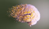 Neue Alzheimer-Hoffnung: Was das neue Medikament kann und für wen es geeignet ist