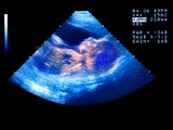 Medizinische Revolution: Erste Babys mit 3 Eltern geboren