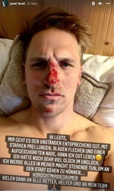 Horror-Sturz von Ferstl bei Kitz-Auftakt