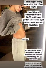 Hailey Bieber