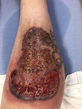 Knie