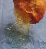 Implantate