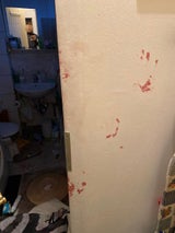 Frau brutal verprügelt: Staatsanwalt rollt Fall neu auf