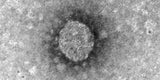 So sieht das 'österreichische' Coronavirus aus