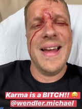 Pocher covert Falco-Hit für Wendler-Parodie