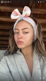 Auf Instagram Stories zeigt sich die 19-Jährige Leni Klum von ihrer natürlichen Seite.&nbsp;