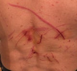 Vater schwer verletzt2