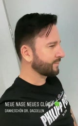 Wendler: Neue Nase trotz Megapleite