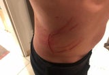 Vater schwer verletzt 4