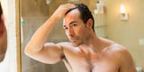 Haarausfall: Symptome, Ursachen und Behandlung