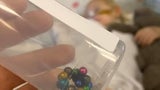 Löcher in den Organen: Mädchen (2) schluckt 21 Magnet-Kugeln