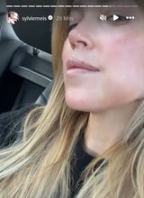 Auf dem Heimweg zeigt Sylvie Meis noch einmal ihre geschwollene Backe.&nbsp;