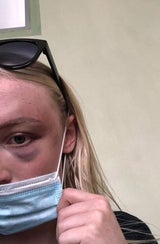 Schock-Fotos: Model zeigt, wie ihre Beziehung zum Alptraum wurde