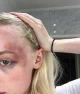 Schock-Fotos: Model zeigt, wie ihre Beziehung zum Alptraum wurde