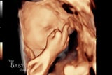 Ungeborenes Baby zeigt Eltern im Ultraschall Mittelfinger