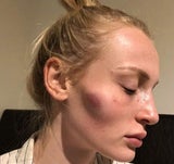 Schock-Fotos: Model zeigt, wie ihre Beziehung zum Alptraum wurde