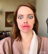 Emma Stone