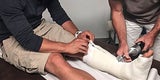 Hirscher Gips