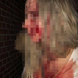 Mädchen im Club von Grapscher verprügelt