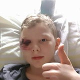 Ast-Attacke auf Kinder: Phantombild