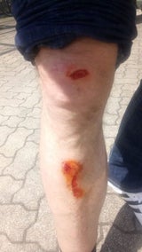 Auto-Lenker rastet aus und schlägt Mopedfahrer nieder