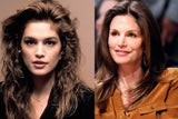 Beauty-OPs der Stars im Check