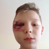 Ast-Attacke auf Kinder: Phantombild